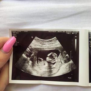 Meet your Posher, Wanda